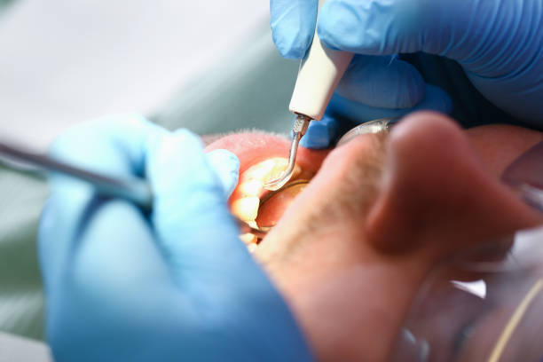Best Weekend Emergency Dentist in Morse, LA
